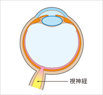 緑内障 松山　眼科　たてまつ眼科　松山市　愛媛　愛媛県